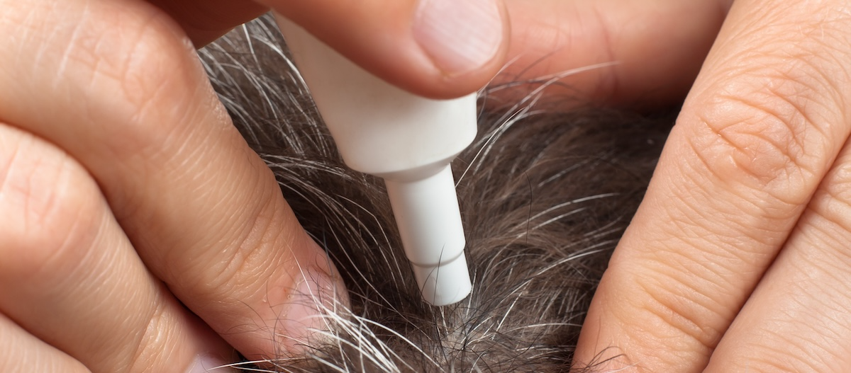 Hand traeufelt Zeckenschutz in Hundefell Hand traeufelt Zeckenschutz in Hundefell